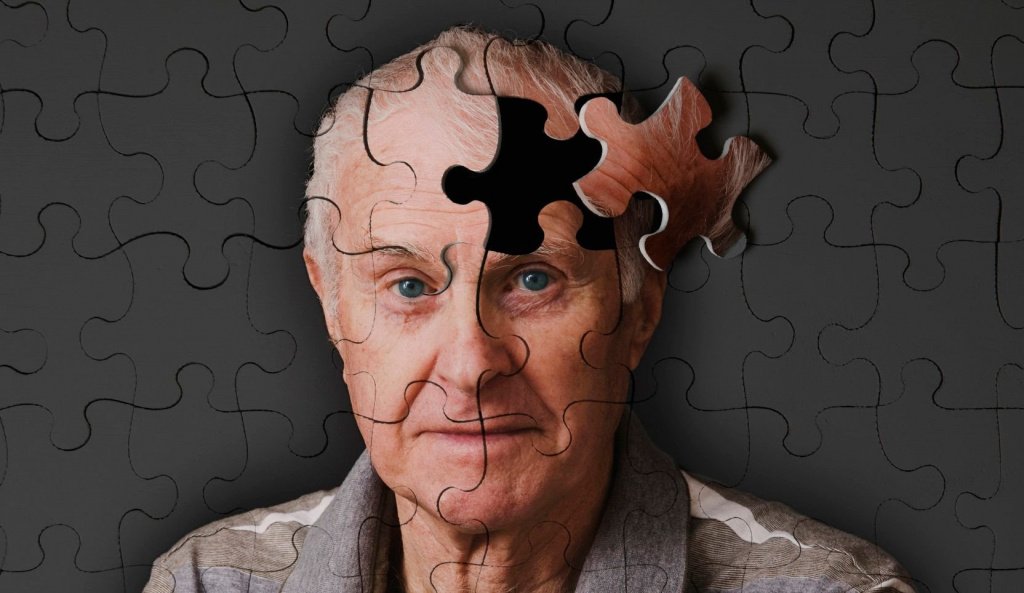 Деменция альцгеймеровского типа